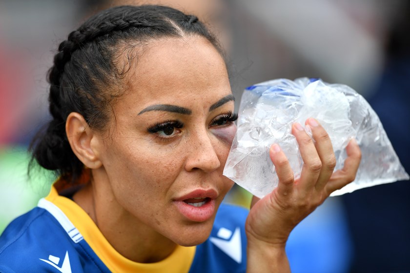 Eels hooker Therese Aiton suffered heavy swelling under her left eye
