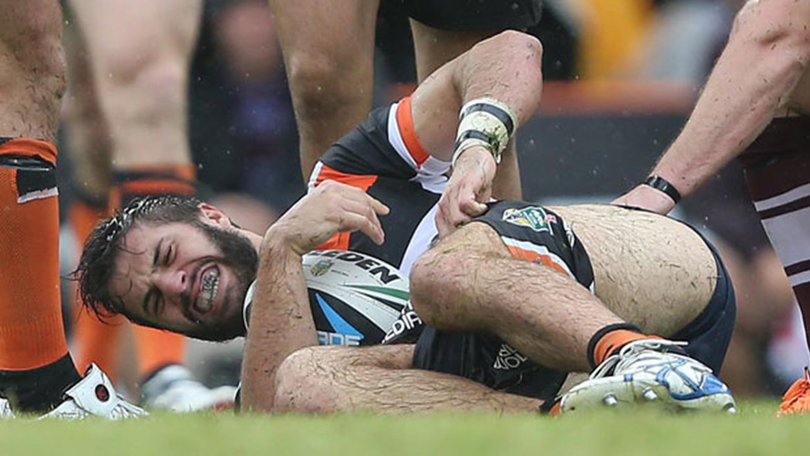 Wests Tigers fullback James Tedesco is facing a stint on the sidelines after suffering an ankle injury against Manly on Sunday. Copyright: Robb Cox/NRL Photos