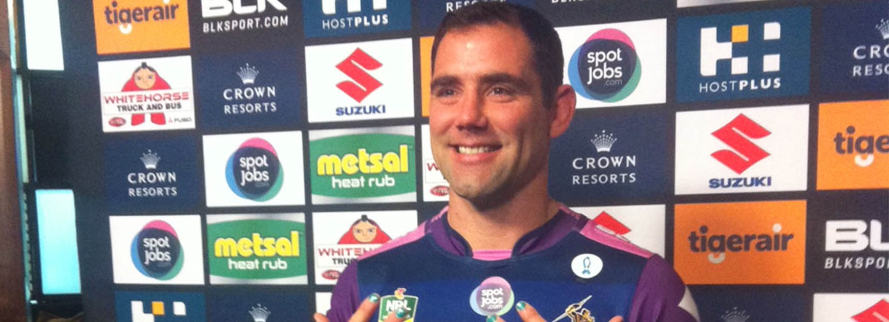 Cam Smith shows off his teal-coloured nails to raise awareness for Ovarian Cancer Australia.