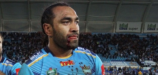 Taia to play with 26 stitches in face
