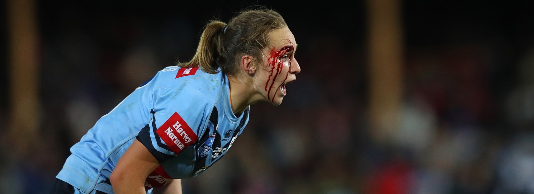 Spilling a bit of blood for your team is what Origin's about