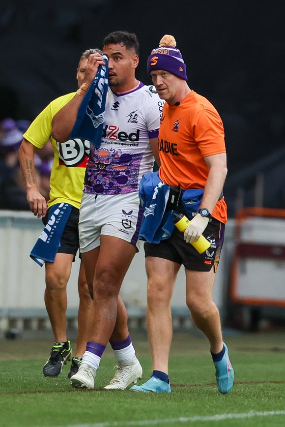 Eliesa Katoa required surgery after a poke in the eye against Cronulla 