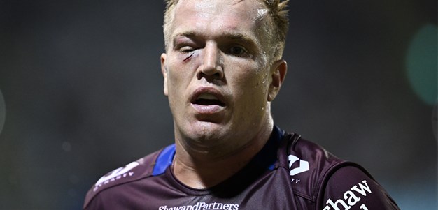 NRL Casualty Ward: Facial injury sidelines Jake; Panthers lose Martin