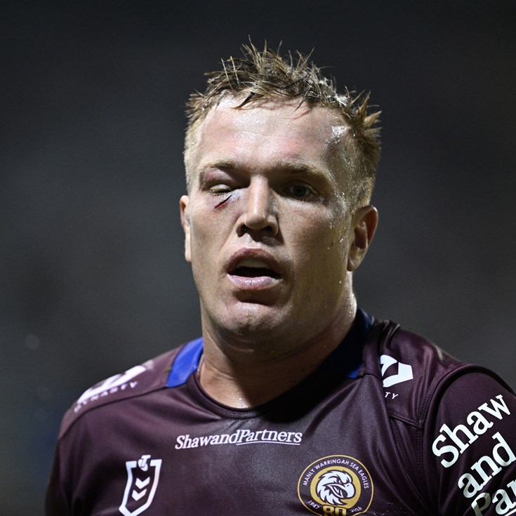 NRL Casualty Ward: Facial injury sidelines Jake; Broncos' double blow